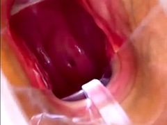 Vagina, cervix Rhythmically hit the orgasm vaginal endoscope with strong suction, squeezing and raising the spike.