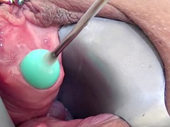 Stim99s eyehole fucked brutally with a huge dildo